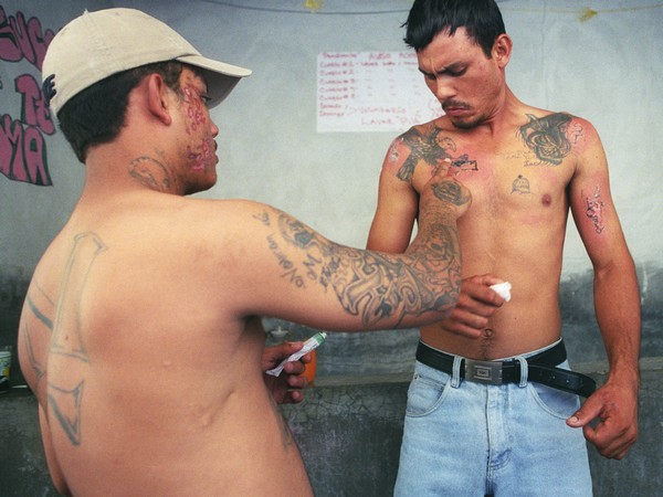 youth-gang-members-remove-tattoos